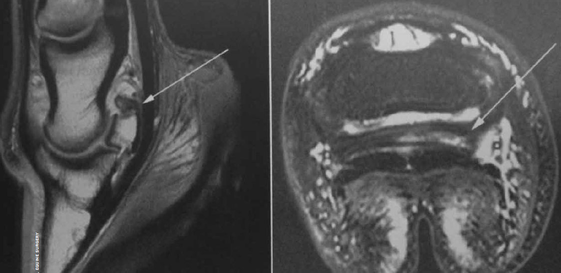 NAVICULAR ISSUES